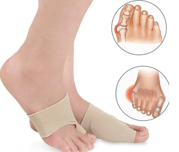 Gel Bunion Sleeve